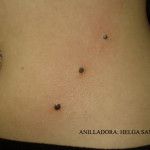 microdermal cadera